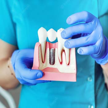 Chartwell Dental Services 005