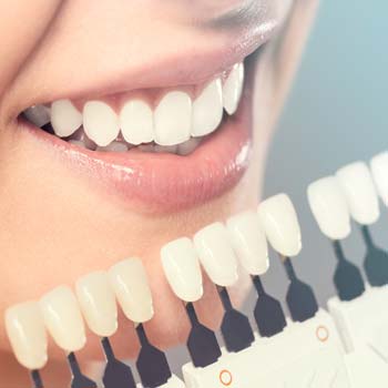 Chartwell Dental Services 003
